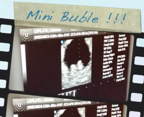 Michael Buble Luisana Lopilato's baby sonogram
